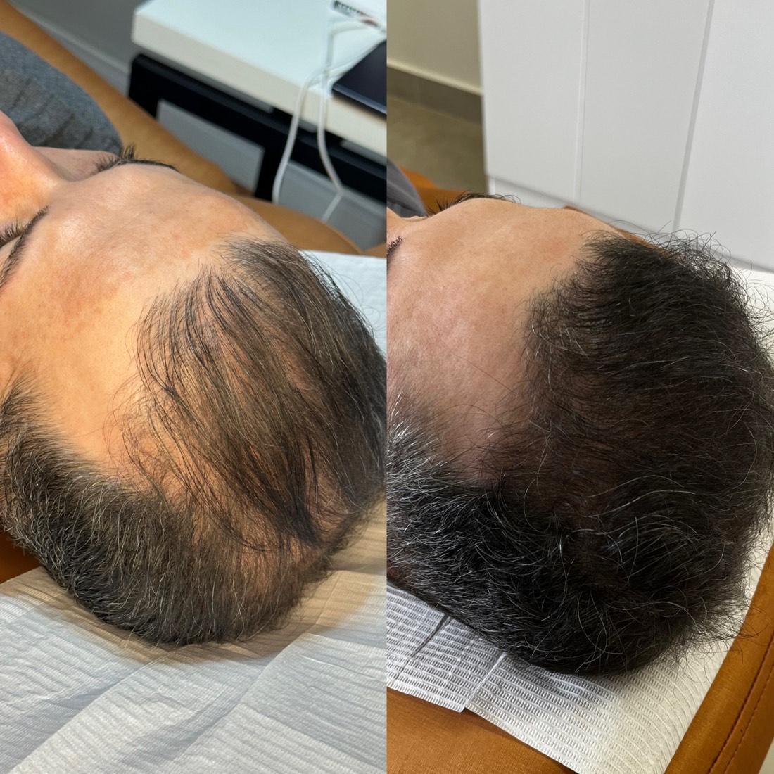 Antes e depois — recuperação capilar no Instituto MV
