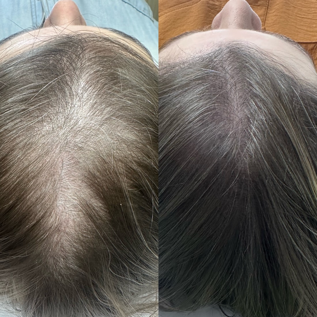 Antes e depois — recuperação capilar no Instituto MV